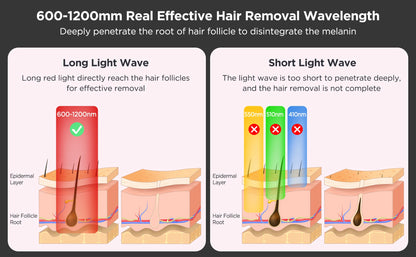 INNZA Haarentfernung mit Eiskühlungs-Pflegefunktion für Frauen, dauerhaft, 999.999 Blitze, schmerzloses IPL-Haarentfernungsgerät