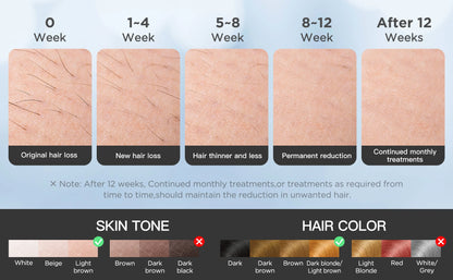 INNZA Haarentfernung mit Eiskühlungs-Pflegefunktion für Frauen, dauerhaft, 999.999 Blitze, schmerzloses IPL-Haarentfernungsgerät