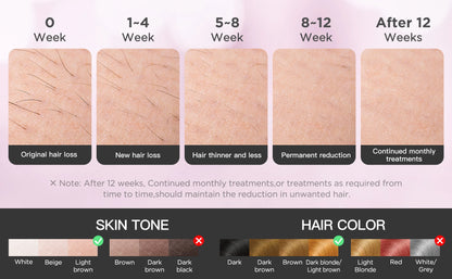 INNZA Haarentfernung mit Eiskühlungs-Pflegefunktion für Frauen, dauerhaft, 999.999 Blitze, schmerzloses IPL-Haarentfernungsgerät