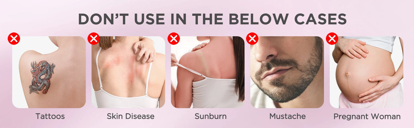 INNZA Haarentfernung mit Eiskühlungs-Pflegefunktion für Frauen, dauerhaft, 999.999 Blitze, schmerzloses IPL-Haarentfernungsgerät