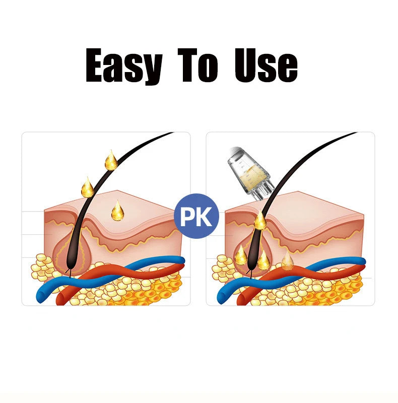 Mini Kopfhaut-Massagekamm mit Flüssigkeitsapplikator – Haaröl- und Serum-Aufsatz gegen Haarausfall